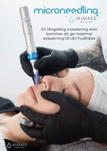 Microneedling i Helsingborg |Hudföryngring