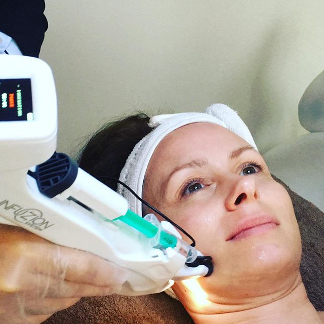 Infuzion skinbooster Helsingborg Angelique hud & kropp